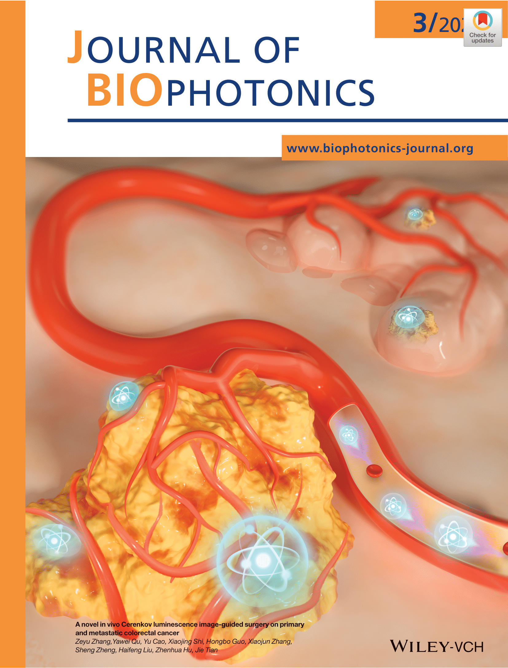 LetPub Journal Cover Art Design - A novel in vivo Cerenkov luminescence image‐guided surgery on primary and metastatic colorectal cancer